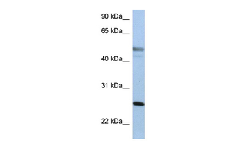 KRT8 Rabbit Polyclonal Antibody