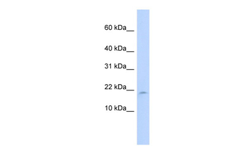 LAIR2 Rabbit Polyclonal Antibody