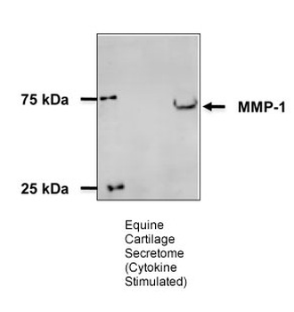 MMP1 Rabbit Polyclonal Antibody