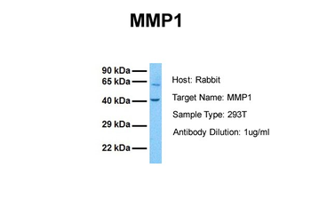 MMP1 Rabbit Polyclonal Antibody
