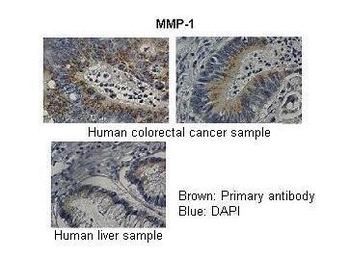 MMP1 Rabbit Polyclonal Antibody