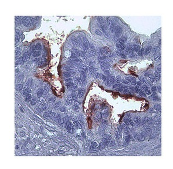 MMP1 Rabbit Polyclonal Antibody