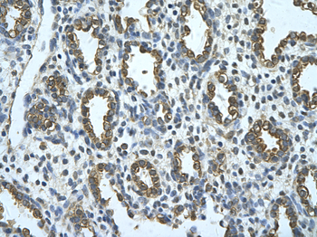 MMP1 Rabbit Polyclonal Antibody
