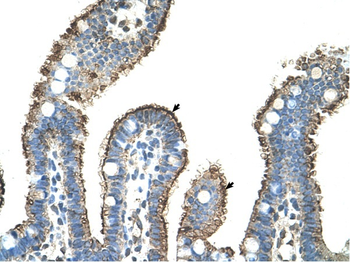 MMP1 Rabbit Polyclonal Antibody