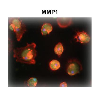 MMP1 Rabbit Polyclonal Antibody