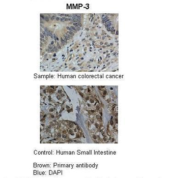 MMP3 Rabbit Polyclonal Antibody