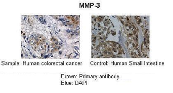 MMP3 Rabbit Polyclonal Antibody
