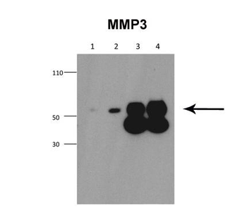 MMP3 Rabbit Polyclonal Antibody