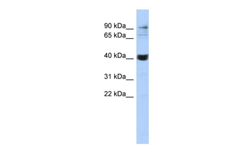 MMP3 Rabbit Polyclonal Antibody