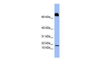 PF4V1 Rabbit Polyclonal Antibody