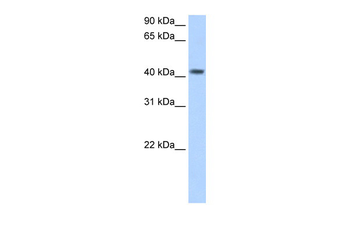 PSG5 Rabbit Polyclonal Antibody