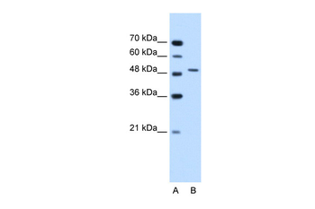 SEMG1 Rabbit Polyclonal Antibody
