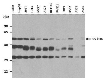 SLC2A5 Rabbit Polyclonal Antibody