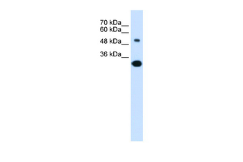 SLC2A5 Rabbit Polyclonal Antibody