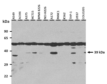 SLC10A1 Rabbit Polyclonal Antibody