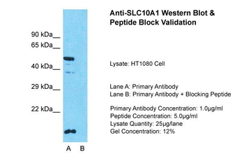 SLC10A1 Rabbit Polyclonal Antibody