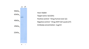 SLC10A1 Rabbit Polyclonal Antibody