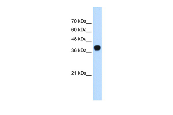 SQLE Rabbit Polyclonal Antibody