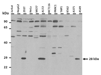 STC1 Rabbit Polyclonal Antibody