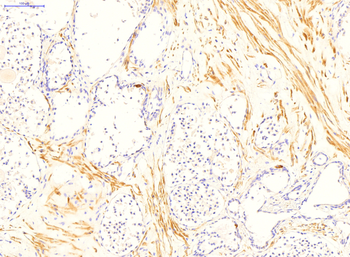 TGM4 Rabbit Polyclonal Antibody