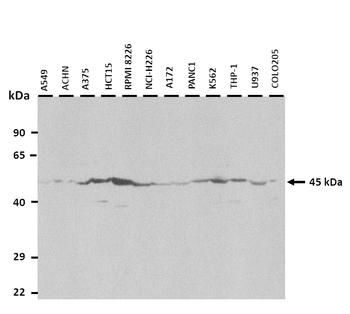 UGCG Rabbit Polyclonal Antibody