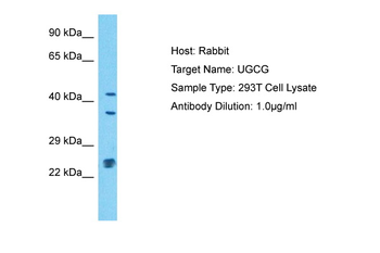 UGCG Rabbit Polyclonal Antibody