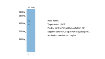 UGCG Rabbit Polyclonal Antibody
