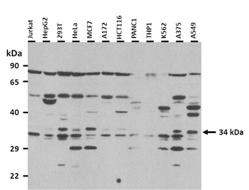 UPP1 Rabbit Polyclonal Antibody