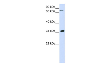 UPP1 Rabbit Polyclonal Antibody