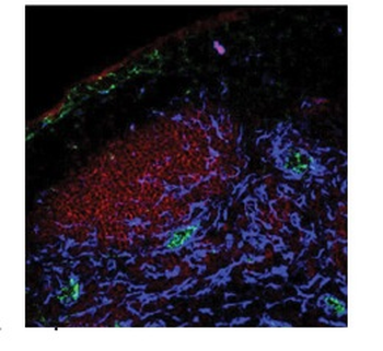 PLPP1 Rabbit Polyclonal Antibody