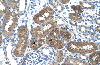 SOCS1 Rabbit Polyclonal Antibody