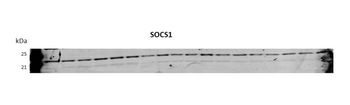 SOCS1 Rabbit Polyclonal Antibody