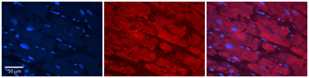 CES2 Rabbit Polyclonal Antibody