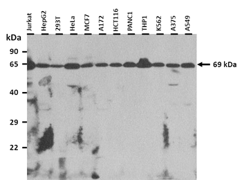 DMPK Rabbit Polyclonal Antibody