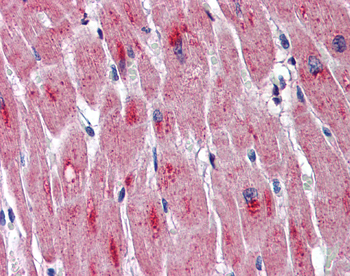 DMPK Rabbit Polyclonal Antibody