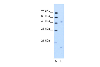 ITGBL1 Rabbit Polyclonal Antibody
