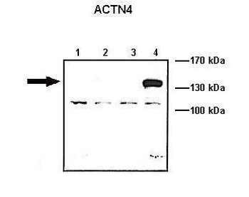 ACTN4 Rabbit Polyclonal Antibody