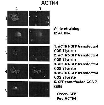 ACTN4 Rabbit Polyclonal Antibody