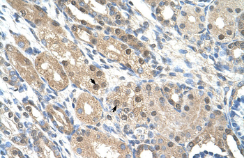 GEM Rabbit Polyclonal Antibody
