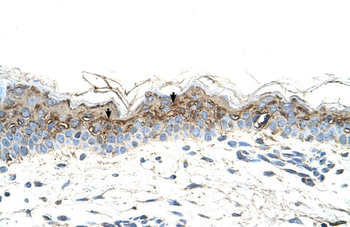 GEM Rabbit Polyclonal Antibody