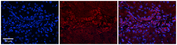GPD1 Rabbit Polyclonal Antibody