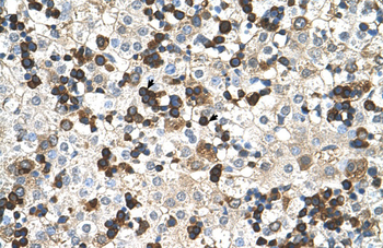 HBZ Rabbit Polyclonal Antibody