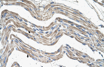 IDH3A Rabbit Polyclonal Antibody