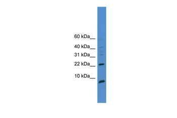 PSCA Rabbit Polyclonal Antibody
