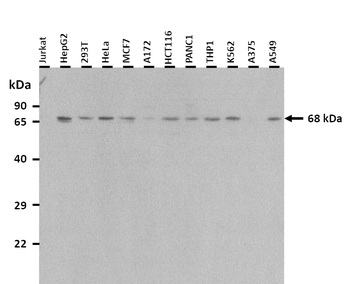 MSLN Rabbit Polyclonal Antibody
