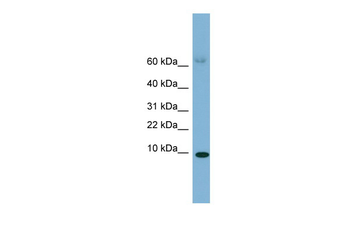 SAA4 Rabbit Polyclonal Antibody