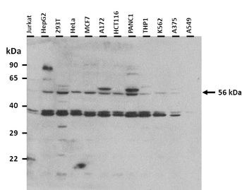 SLC38A3 Rabbit Polyclonal Antibody