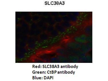 SLC38A3 Rabbit Polyclonal Antibody