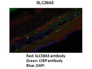 SLC38A3 Rabbit Polyclonal Antibody