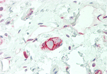 SLC38A3 Rabbit Polyclonal Antibody